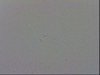 Mesobiotus coronatus image