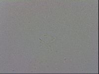 Mesobiotus coronatus image