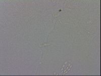 Mesobiotus coronatus image