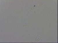 Mesobiotus coronatus image