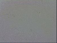 Mesobiotus coronatus image