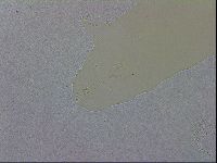 Mesobiotus coronatus image
