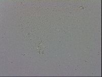Mesobiotus coronatus image