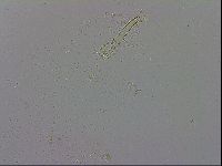 Mesobiotus coronatus image