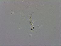 Mesobiotus coronatus image