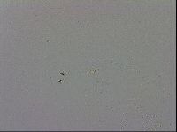 Mesobiotus coronatus image