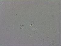 Mesobiotus coronatus image