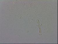 Mesobiotus coronatus image