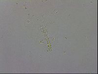 Mesobiotus coronatus image