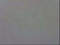 Mesobiotus coronatus image