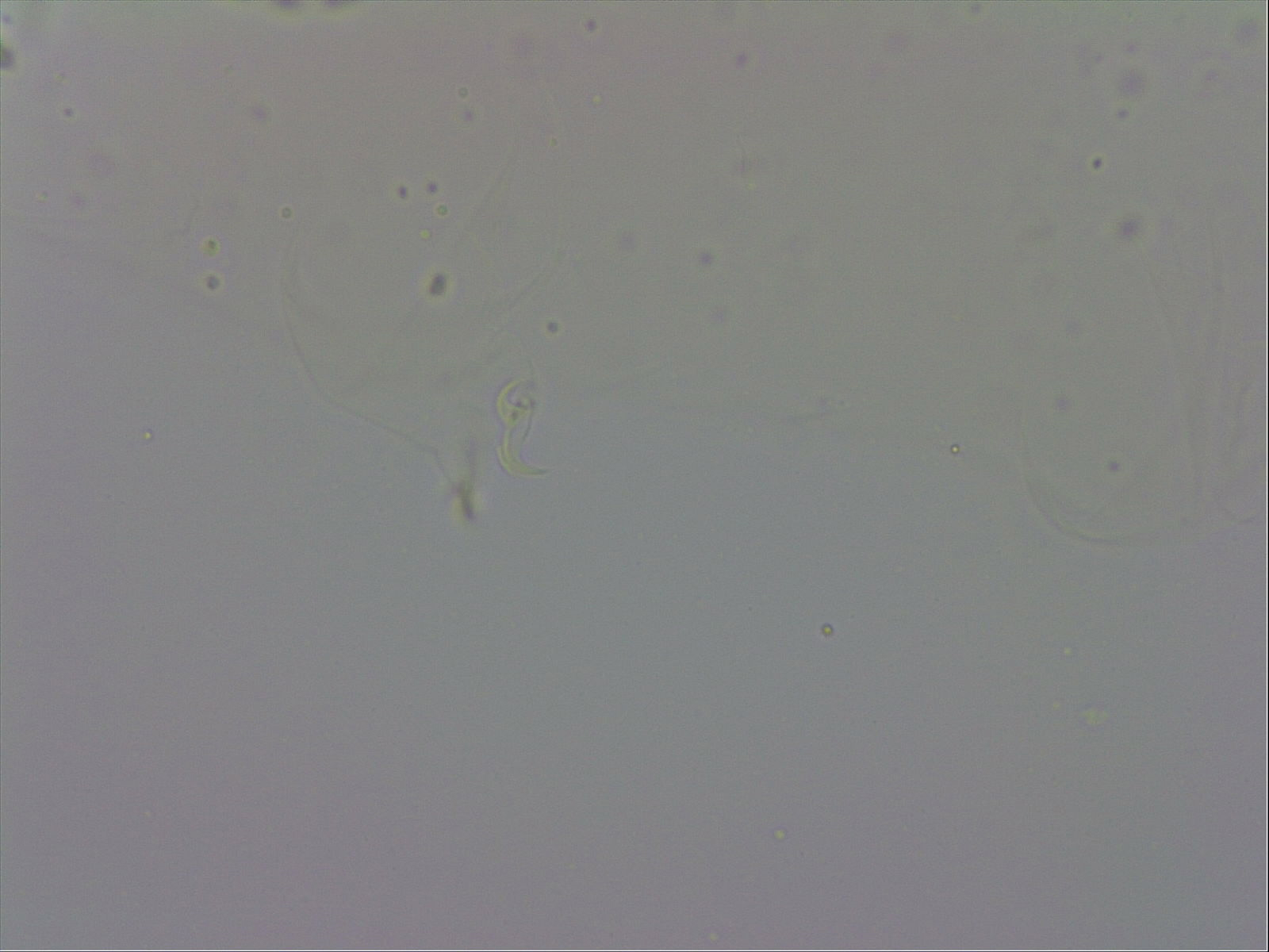 Mesobiotus coronatus image