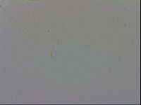Mesobiotus coronatus image