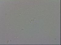 Mesobiotus coronatus image