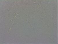 Mesobiotus coronatus image