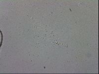 Mesobiotus coronatus image