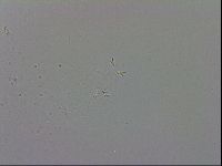 Mesobiotus coronatus image