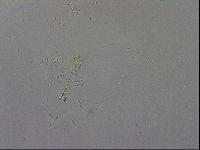 Mesobiotus coronatus image