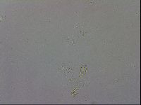 Mesobiotus coronatus image