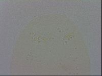 Mesobiotus coronatus image