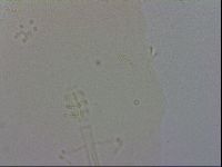Mesobiotus coronatus image