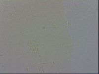 Mesobiotus coronatus image