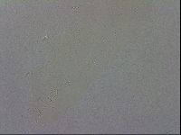Media resource of Mesobiotus coronatus