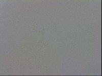 Mesobiotus coronatus image