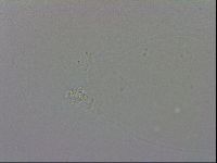 Mesobiotus coronatus image