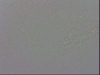 Mesobiotus coronatus image