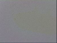 Mesobiotus coronatus image
