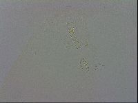 Mesobiotus coronatus image