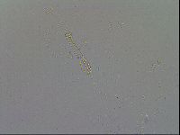 Mesobiotus coronatus image