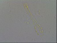 Mesobiotus coronatus image
