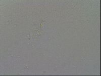 Mesobiotus coronatus image