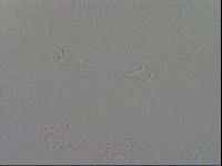 Mesobiotus coronatus image