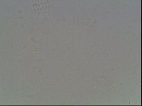 Mesobiotus coronatus image