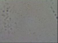 Mesobiotus coronatus image