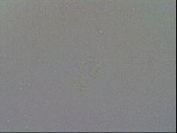Mesobiotus coronatus image