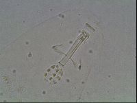 Mesobiotus coronatus image
