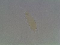 Mesobiotus coronatus image