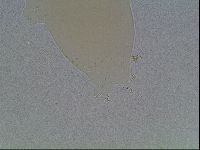 Mesobiotus coronatus image