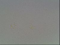 Mesobiotus coronatus image