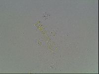 Mesobiotus coronatus image