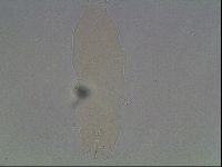 Mesobiotus coronatus image