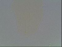 Mesobiotus coronatus image