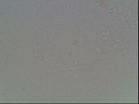 Mesobiotus coronatus image