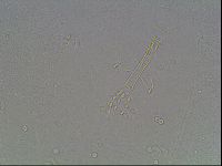 Mesobiotus coronatus image