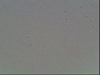 Mesobiotus coronatus image