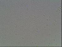Mesobiotus coronatus image