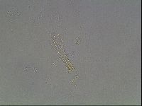 Mesobiotus coronatus image